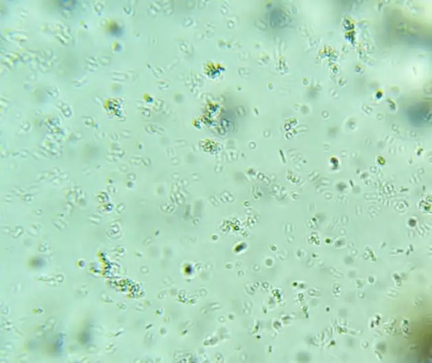 Bacteria under the microscope