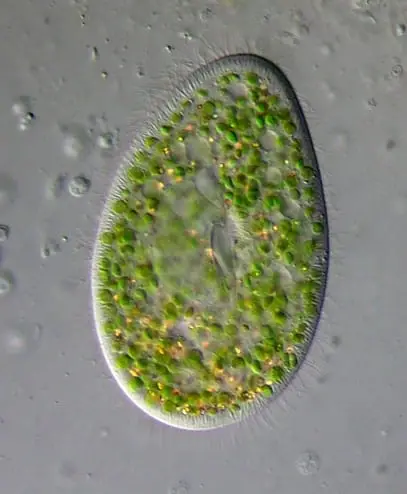 Paramecium Bursaria under a microscope