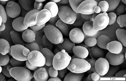 Saccharomyces cerevisiae under an electron microscope