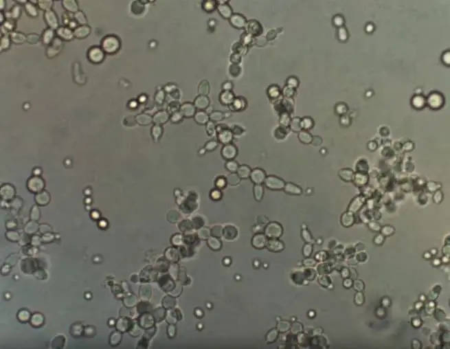 Yeast under a microscope