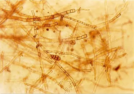 Hyphae under a microscope