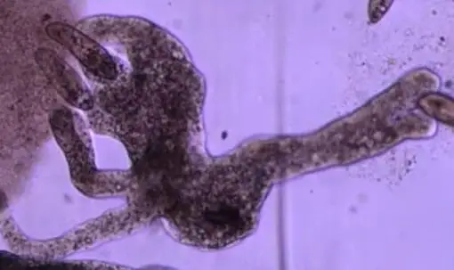 Amoeba under a microscope