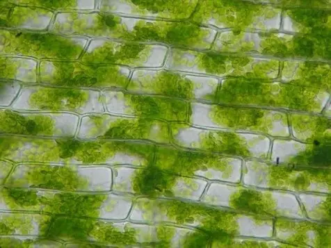 Chloroplasts Under a Microscope