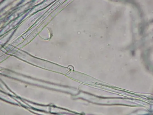 Hypha under a microscope