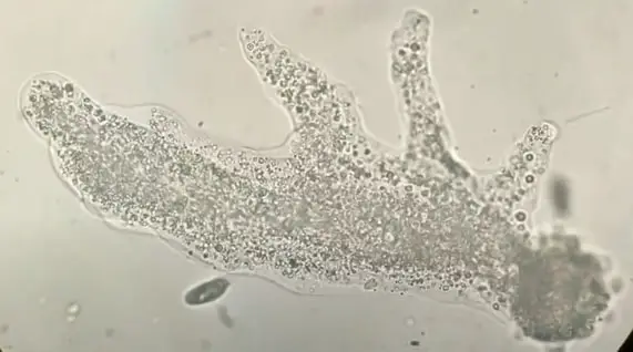 Amoeba under a microscope. 