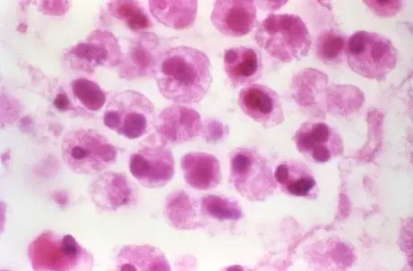 Cytoplasm with a bright pink color from eosin stain