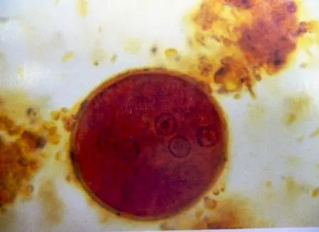 Entamoeba coli under a microscope