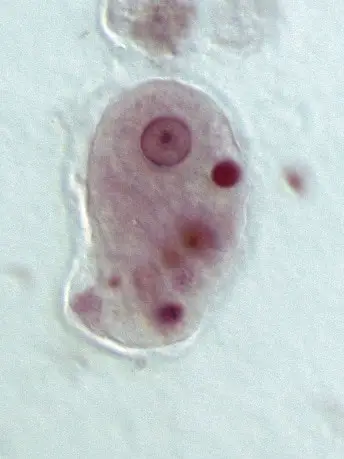 Entamoeba histolytica under a microscope