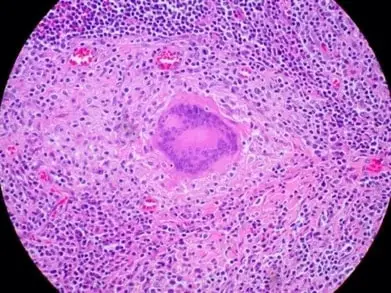 Langshan's Cells cytoplasm