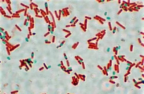 Schaeffer–Fulton stain or an endospore stain for bacteria identification