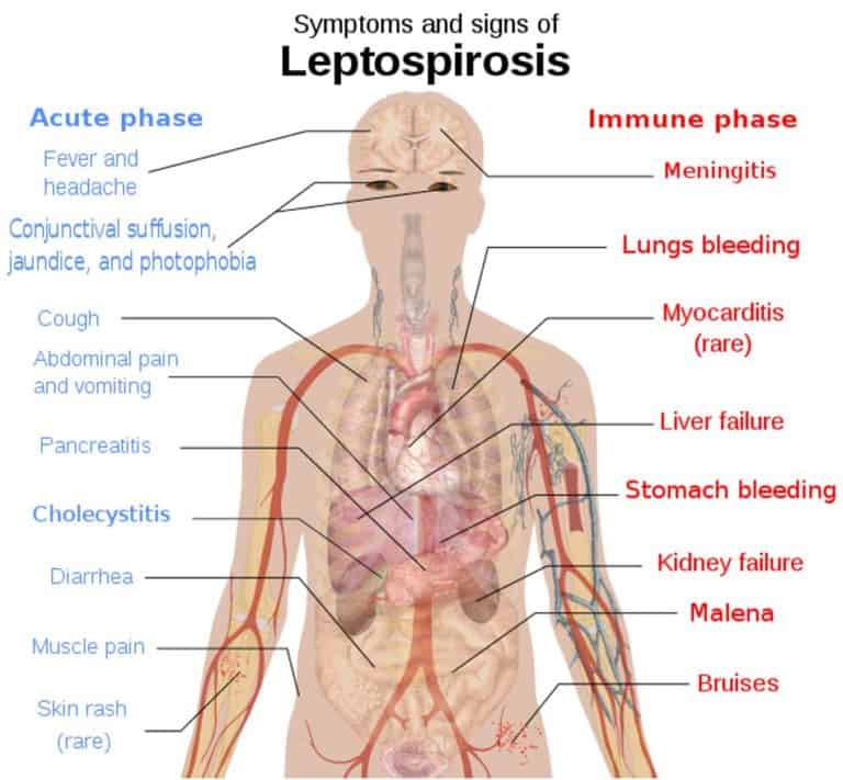 What Are Spirilla Bacteria? Microscope Clarity