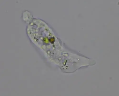 What is an Amoeba? – Microscope Clarity