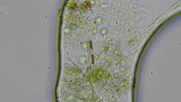 diatom algae