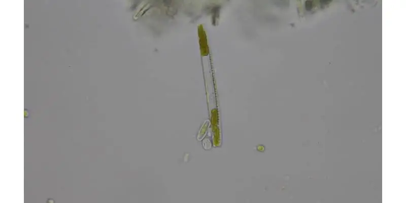 diatoms under microscope 400x