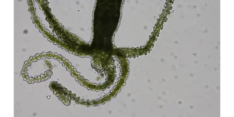 What is Hydra? (Microorganism) – Microscope Clarity