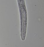 Nematodes: Classification, Structure, and Characteristics – Microscope ...