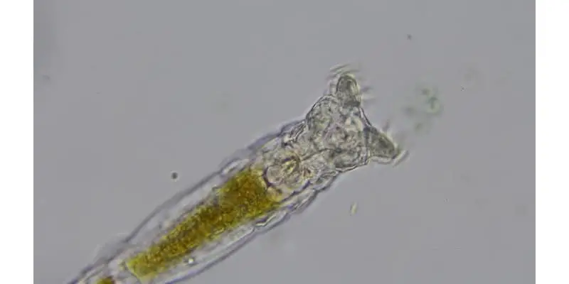 rotifer under a microscope