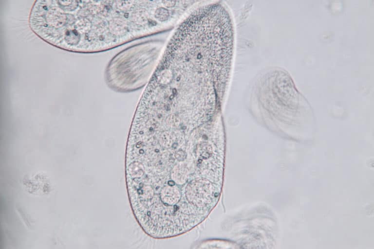 what-is-a-contractile-vacuole-microscope-clarity