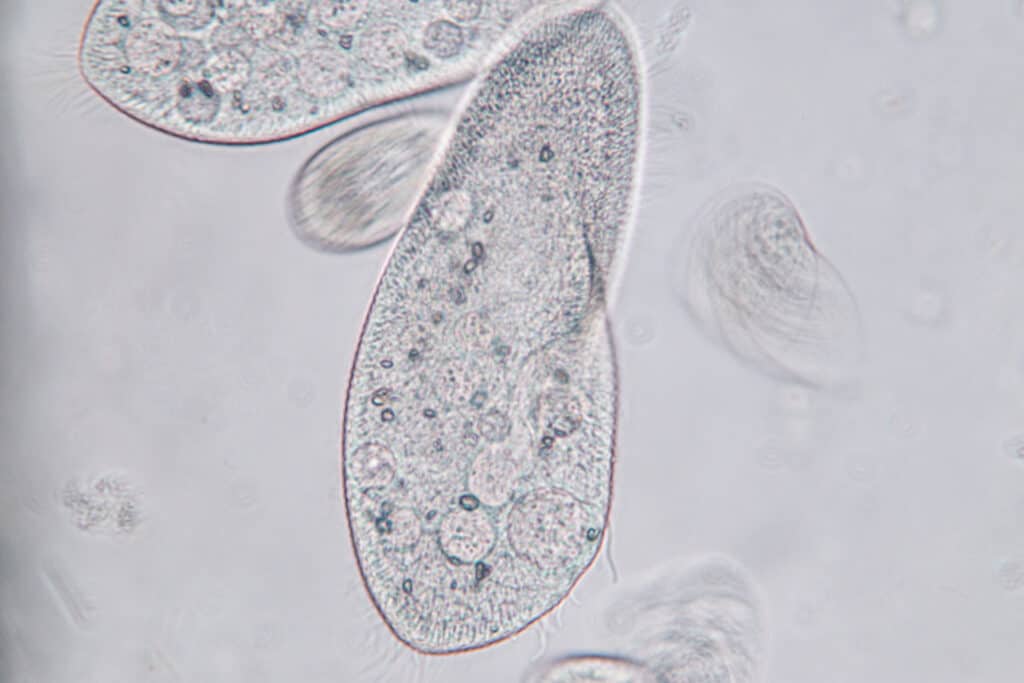 what-is-a-contractile-vacuole-microscope-clarity