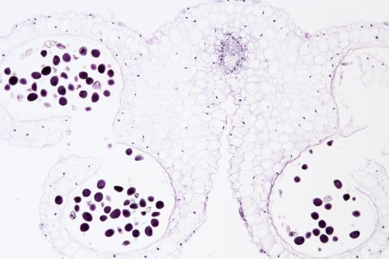 What Is Brightfield Microscopy? Microscope Clarity