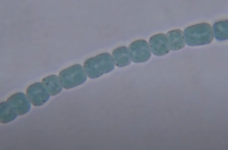 Anabaena: Classification and Characteristics – Microscope Clarity